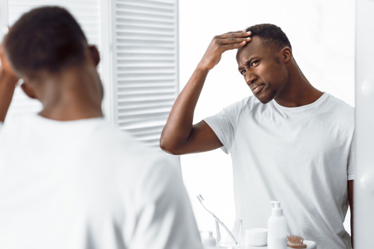 Reclaiming the Crown: Understanding and Addressing Hair Loss in the Black Community