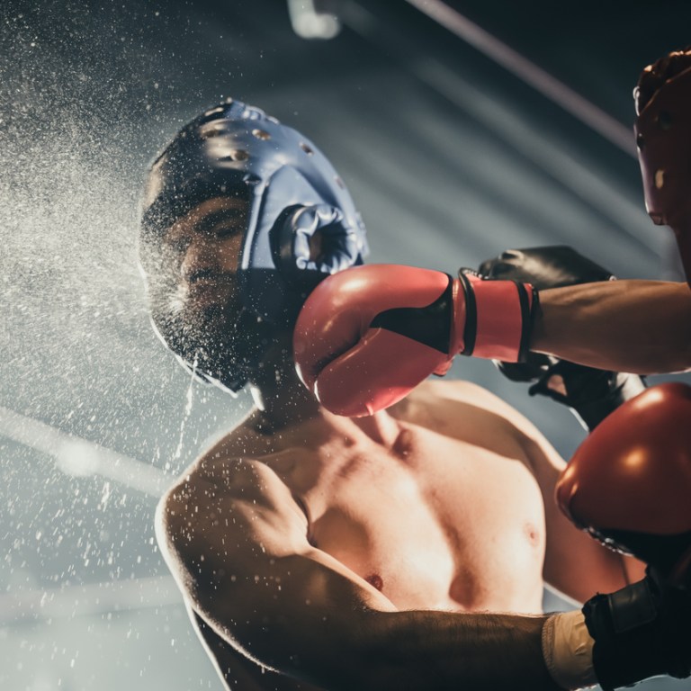 Step into the Ring at Paris 2024: Your Guide to Olympic Boxing